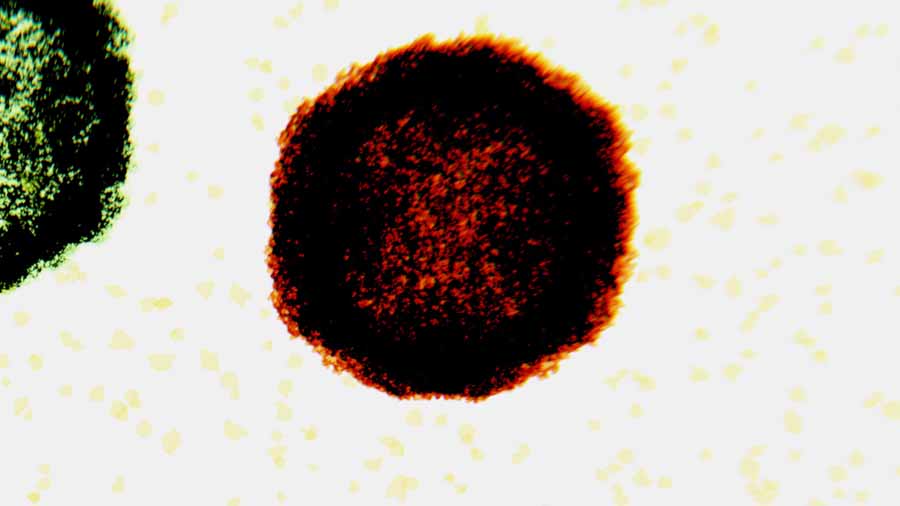 An image of virus EV-D68.