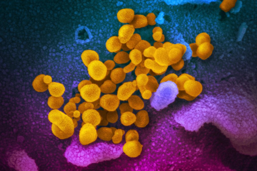 FILE - This undated, colorized electron microscope image made available by the U.S. National Institutes of Health in February 2020 shows the Novel Coronavirus SARS-CoV-2, indicated in yellow, emerging from the surface of cells, indicated in blue/pink, cultured in a laboratory. The sample was isolated from a patient in the U.S. There’s less risk of getting long COVID in the omicron era than in the pandemic’s earlier waves, according to a study of nearly 10,000 Americans that aims to help scientists better understand the mysterious condition, published in JAMA on Thursday, May 25, 2023. (NIAID-RML via AP, File)