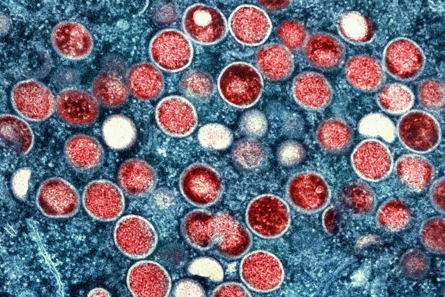 FILE - This colorized electron microscope image provided by the National Institute of Allergy and Infectious Diseases shows mpox particles, red, found within an infected cell, blue, cultured in a laboratory in Fort Detrick, Md. A study released by the U.S. Centers for Disease Control and Prevention on Thursday, May 25, 2023, suggests dozens of U.S. cities are at risk for mpox outbreaks this summer. Health officials say they are working to prevent the scale of infections that surprised the nation the previous summer. (NIAID via AP, File)