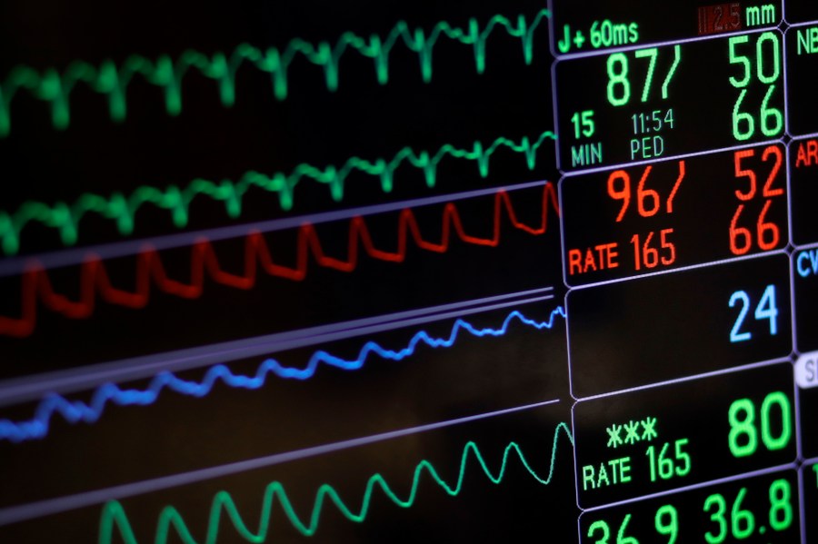 FILE - A screen displays a patient's vital signs at a hospital in Baltimore on Nov. 28, 2016. Research published in the New England Journal of Medicine on Friday, June 16, 2023, suggests testosterone replacement therapy is safe for men with “low T” who have cardiovascular disease or are at high risk for it. But doctors say men shouldn’t view the treatment as an “anti-aging tonic.” (AP Photo/Patrick Semansky, File)