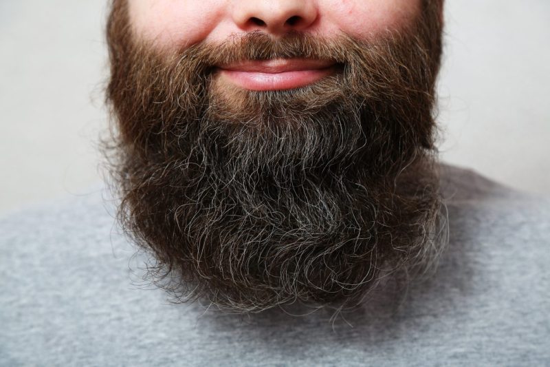 This image shows the lower half of a smiling, bearded man's face.