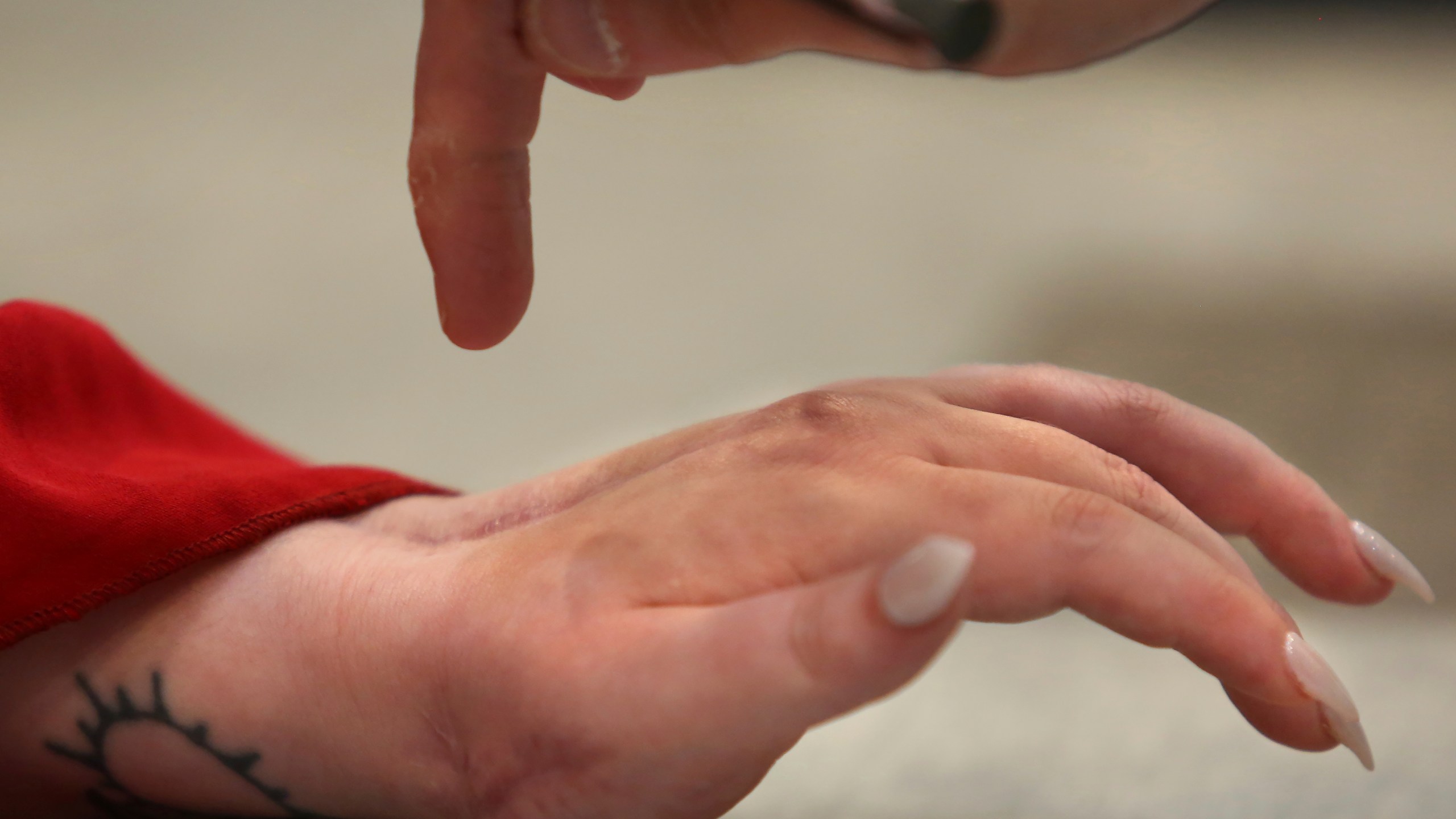 Abby Zwerner, a teacher who was shot at Richneck Elementary School in Newport News, Va., by her 6-year-old student last year, shows reporter Peter Dujardin the scars on her left hand, Wednesday, Jan. 3, 2024, in Virginia Beach, Va. (Stephen M. Katz /The Virginian-Pilot via AP)