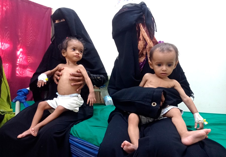 FILE - Women hold their malnourished children at Hays Rural Hospital in Hodeida, Yemen, Oct. 11, 2022. A U.N. report says many countries are bouncing back from the COVID-19 pandemic, but the poorest are not and a significant number are seeing conditions in their country deteriorating. But it says development in half of the world’s poorest countries remains below 2019 pre-pandemic levels. (AP Photo/Hussam Al-Bakry, File)