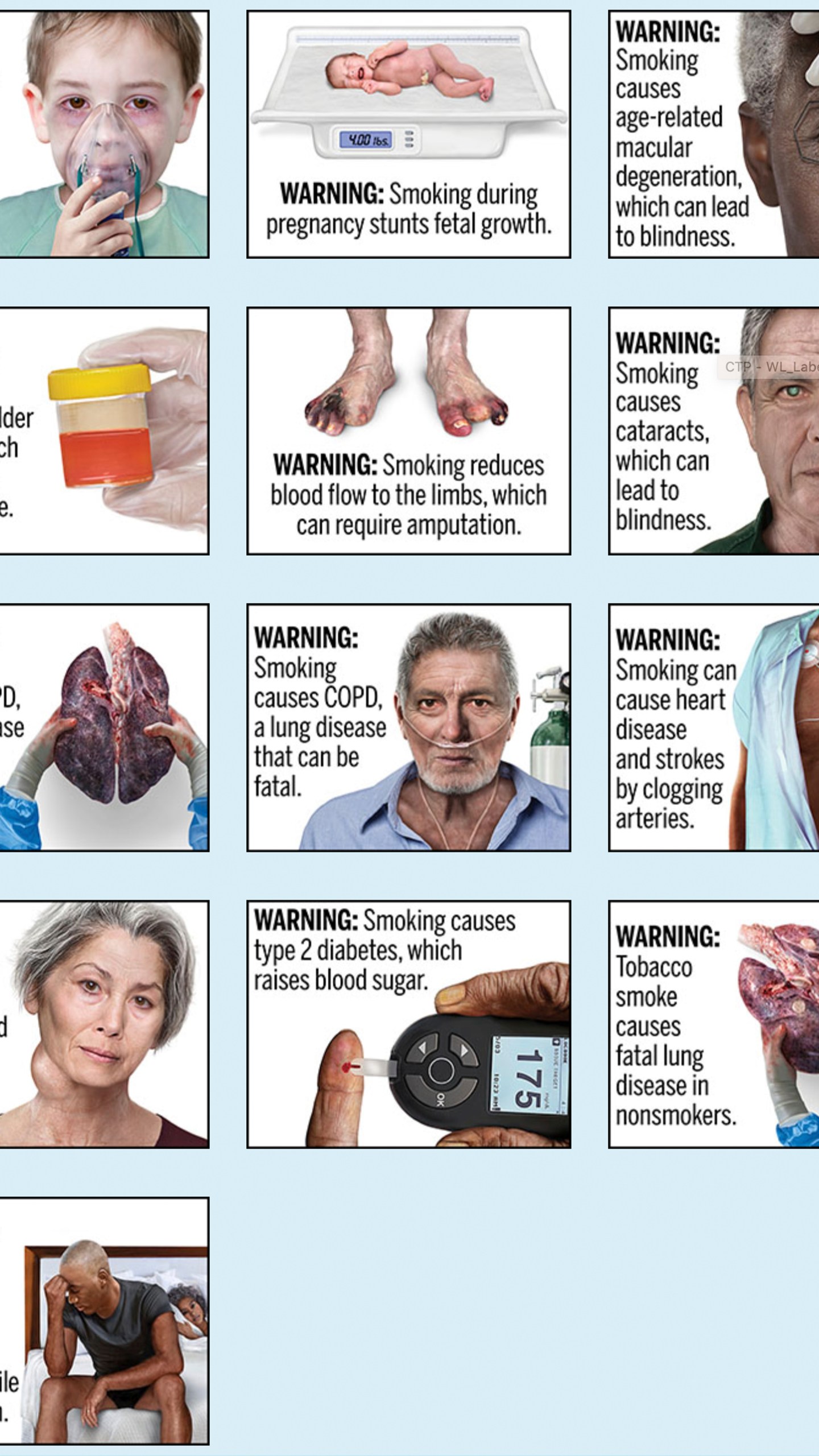 FILE - This image provided by the U.S. Food and Drug Administration, Thursday, Aug. 15, 2019, shows proposed cigarette warning labels. A federal rule requiring that cigarette packs and advertising include graphic images demonstrating the effects of smoking, including pictures of smoke-damaged lungs and feet blackened by diminished blood flow, does not violate the First Amendment, a federal appeals court ruled Thursday, March 21, 2024. (FDA via AP, File)