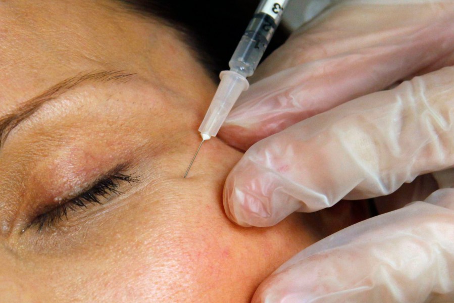 A patient receives a Botox injection at a clinic in Arlington, Va., on June 5, 2009. On Tuesday, April 23, 2024, the Centers for Disease Control and Prevention issued a warning about counterfeit Botox injections after more than 20 people got sick. All of the people told health officials that they got the shots from unlicensed individuals or in settings like homes or spas. (AP Photo/Jacquelyn Martin, File)