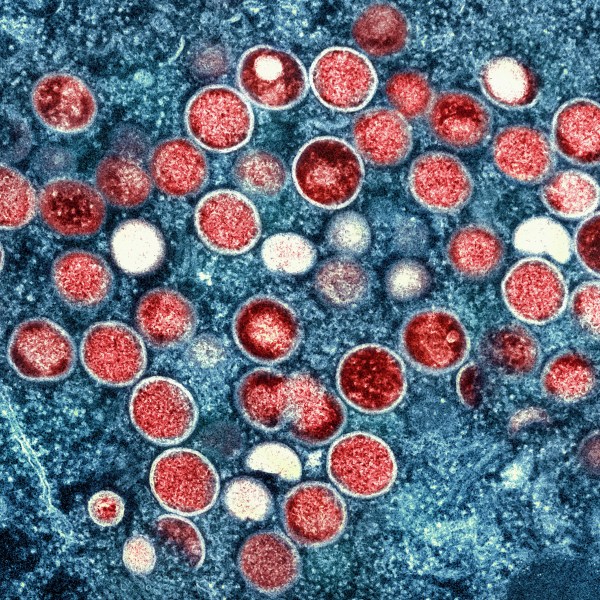 FILE - This image provided by the National Institute of Allergy and Infectious Diseases (NIAID) shows a colorized transmission electron micrograph of monkeypox particles (red) found within an infected cell (blue), cultured in the laboratory that was captured and color-enhanced at the NIAID Integrated Research Facility (IRF) in Fort Detrick, Md. Scientists say a new form of mpox detected in a mining town in Congo might more easily spread among people. Already, Congo is seeing its biggest mpox outbreak with more than 19,000 suspected infections and 900 deaths. (NIAID via AP, File)