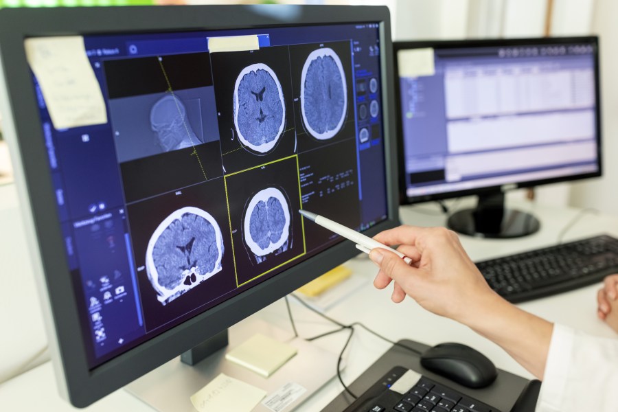 Close-up of female doctor looking at CT scan report on computer monitor. Surgeon with pen viewing at X-ray image on computer screen in hospital.