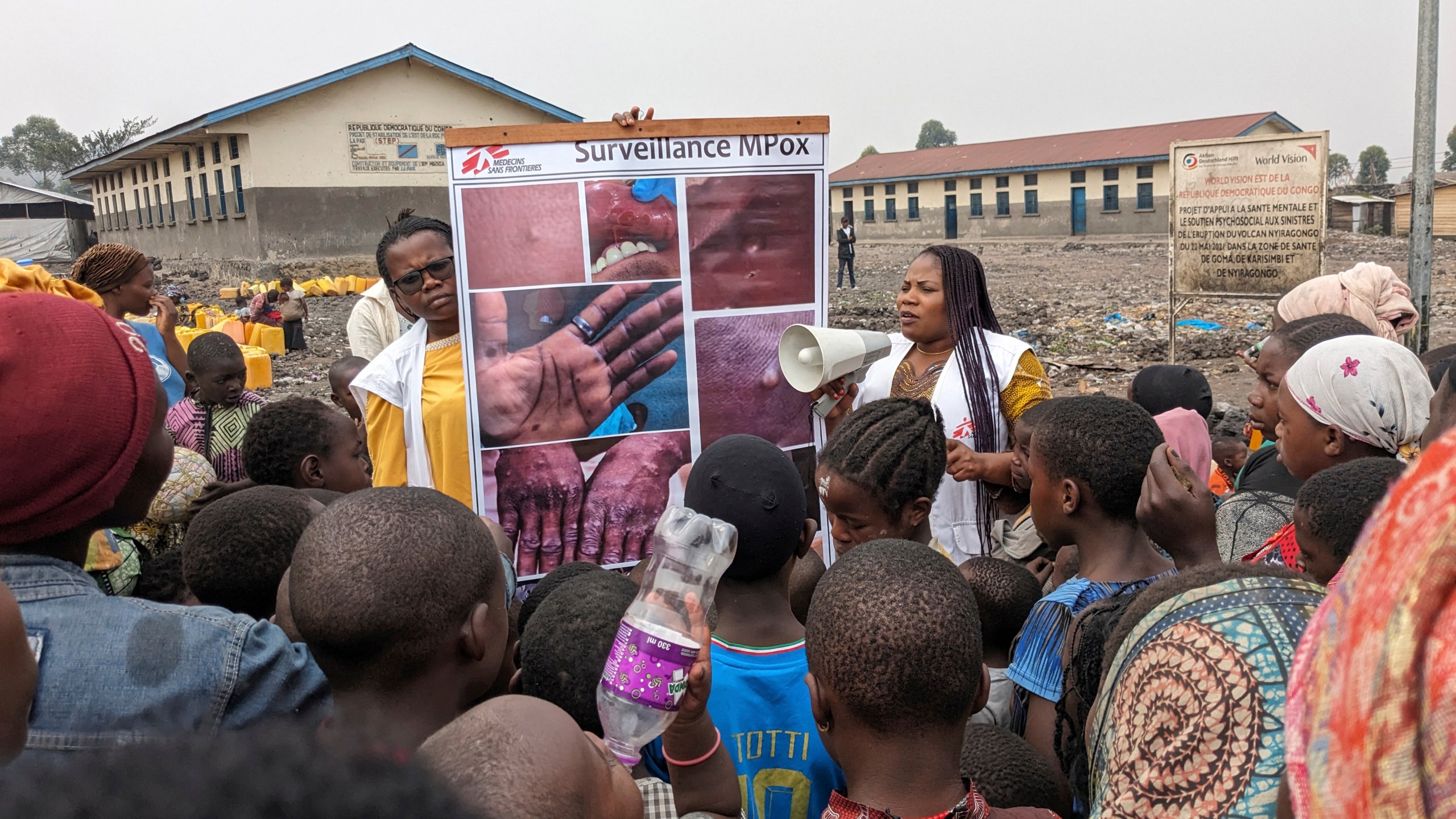 This photo supplied by MSF (Doctors Without Borders) dated May 31, 2023, shows health workers educating children on the symptoms of the mpox disease in Goma, Congo. (Augustin Mudiayi/Doctors Without Borders/Médecins Sans Frontières via AP)