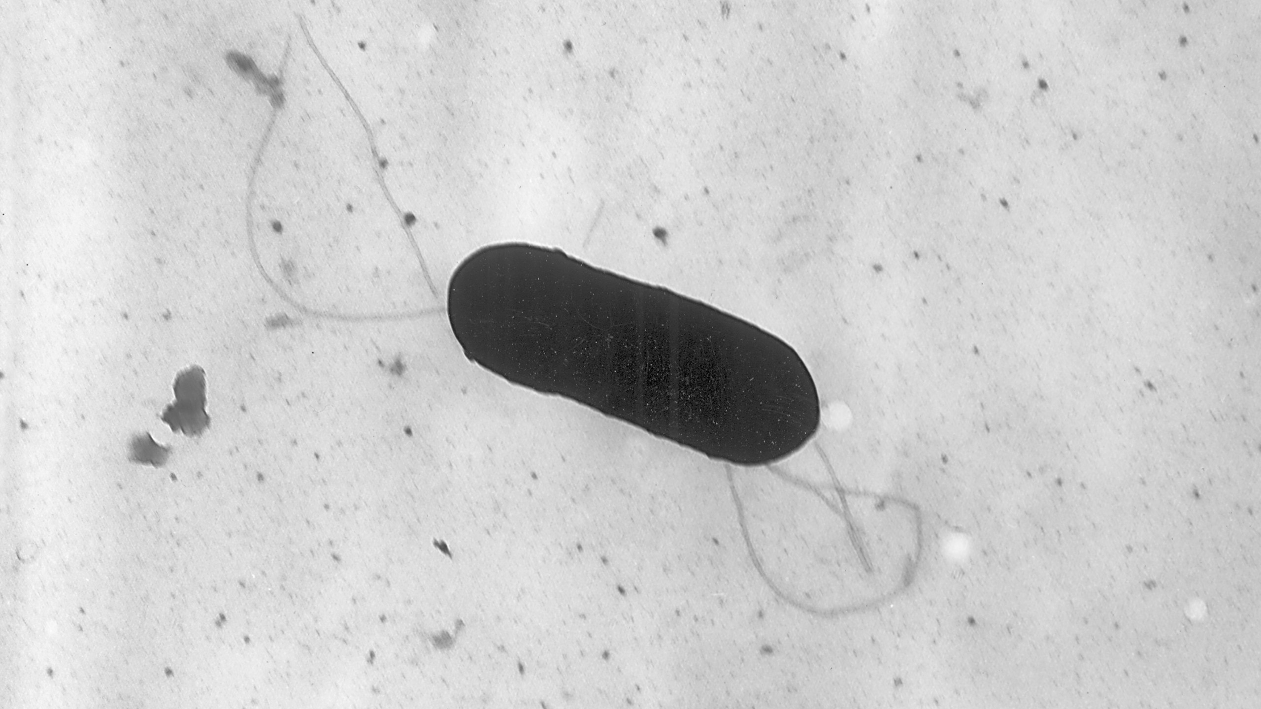 FILE - This 2002 electron microscope image made available by the Centers for Disease Control and Prevention shows a Listeria monocytogenes bacterium. (Elizabeth White/CDC via AP, File)