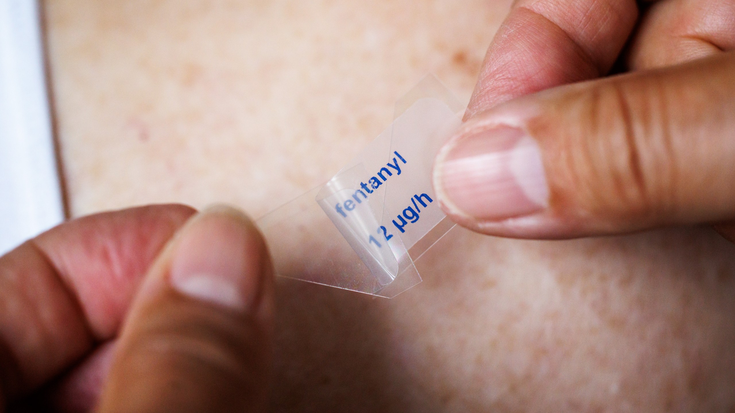 Application of a fentanyl patch