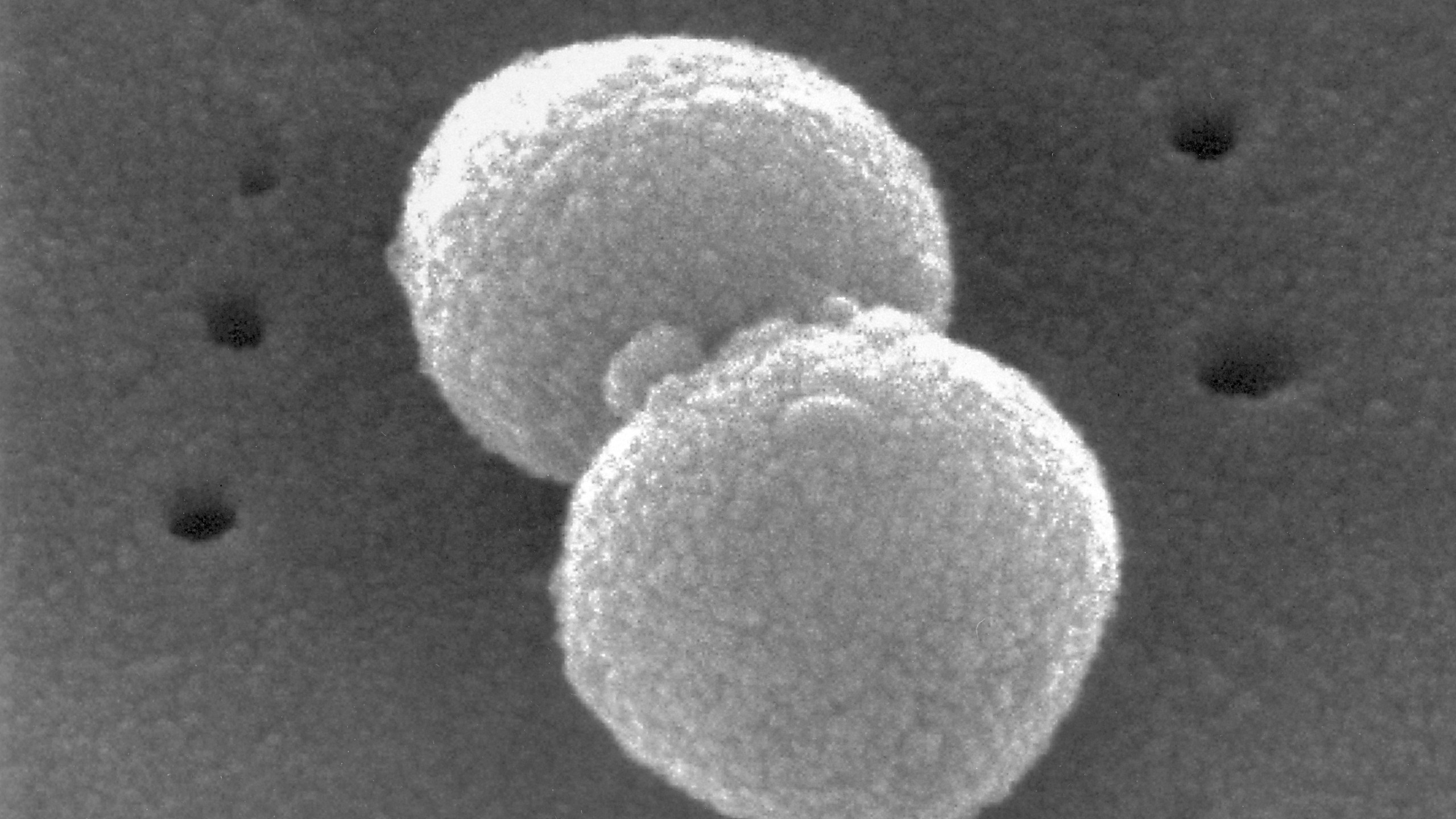 This electron microscopic image provided by the Centers for Disease Control and prevention depicts two, round-shaped, Gram-positive, Streptococcus pneumoniae bacteria. (Janice Haney Carr/CDC via AP)