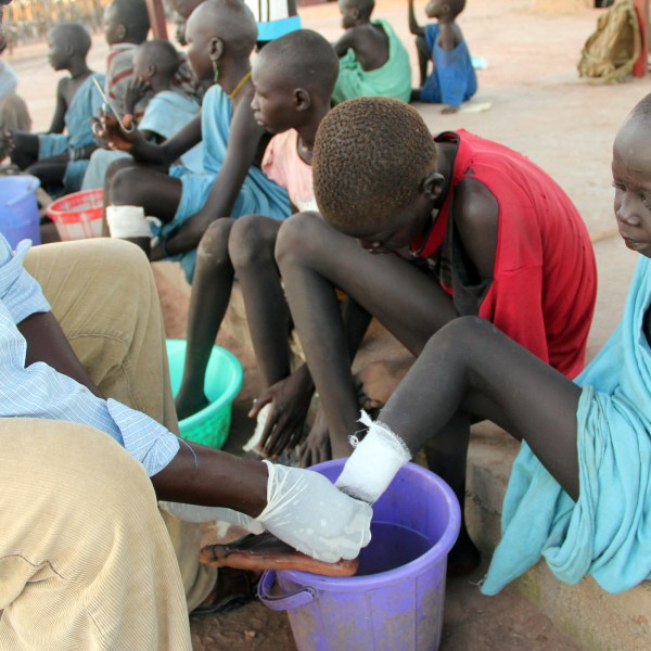 FILE - In this Nov. 4, 2010 photo, Ajak Kuol Nyamchiek, 7, watches while John Lotiki, a nurse with the Carter Center, bandages the blister on her leg from where a guinea worm is slowly emerging in Abuyong, Sudan. (AP Photo/Maggie Fick, File)