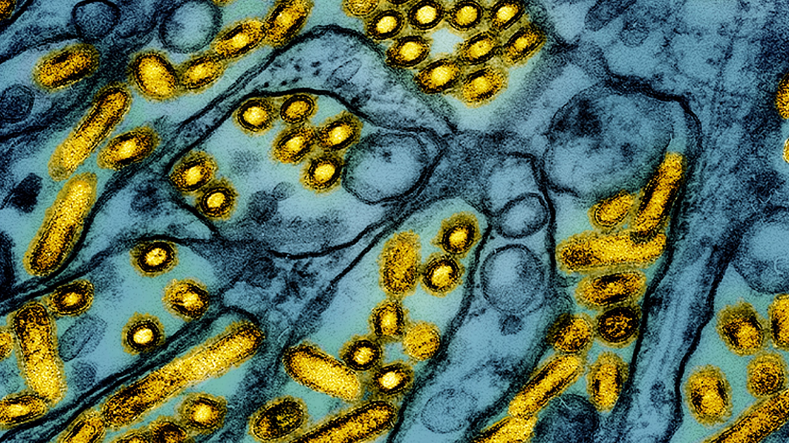 FILE -This colorized electron microscope image released by the National Institute of Allergy and Infectious Diseases on March 26, 2024, shows avian influenza A H5N1 virus particles (yellow), grown in Madin-Darby Canine Kidney (MDCK) epithelial cells (blue). (CDC/NIAID via AP, File)