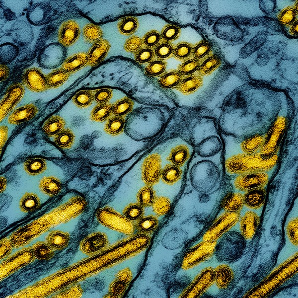 FILE -This colorized electron microscope image released by the National Institute of Allergy and Infectious Diseases on March 26, 2024, shows avian influenza A H5N1 virus particles (yellow), grown in Madin-Darby Canine Kidney (MDCK) epithelial cells (blue). (CDC/NIAID via AP, File)